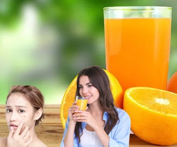 Orange 2025 juice acne